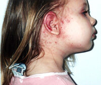 patient Jorden Ruppe