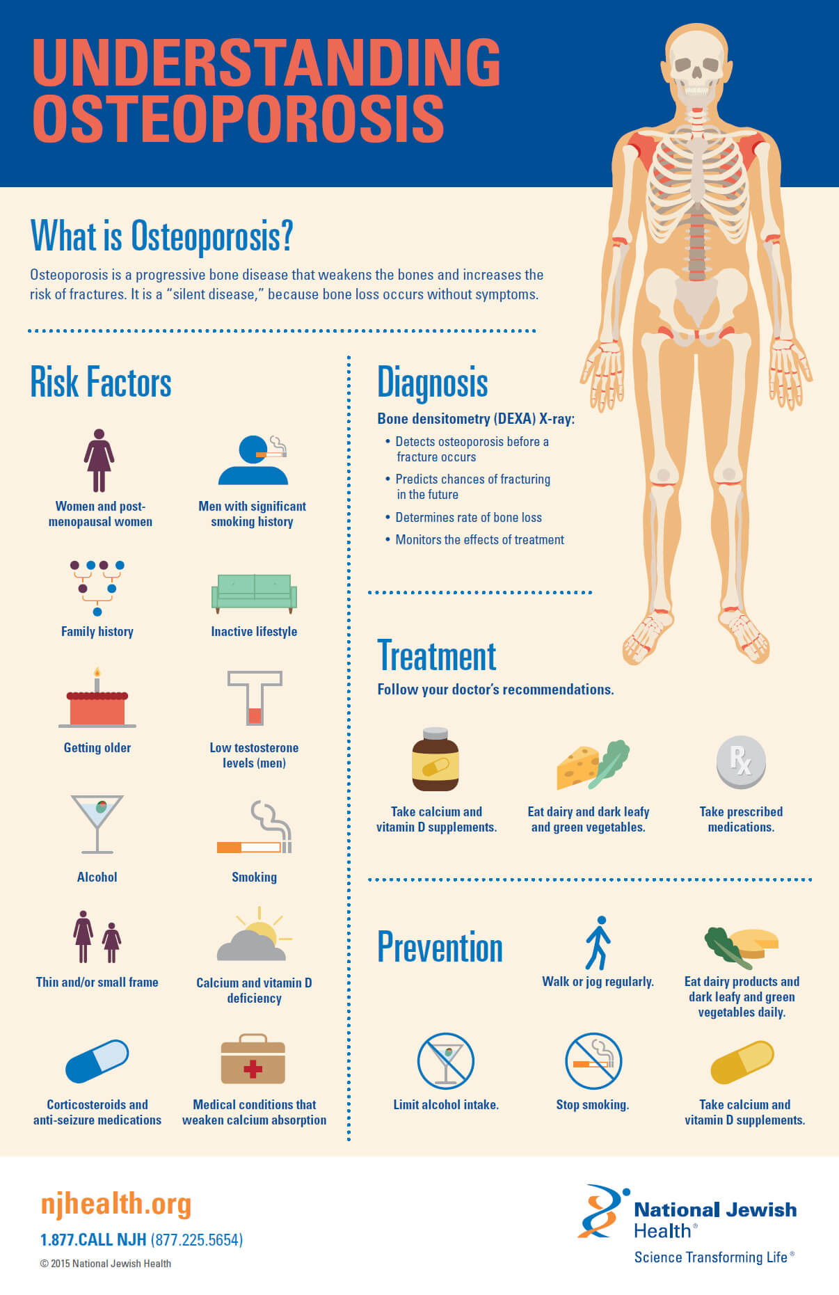 Osteoporosis Signs, Symptoms, Testing, Treatment, 40 OFF