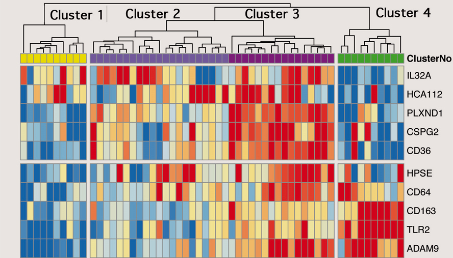Red boxes represent genes that are more active during infection of cystic fibrosis patients’ lungs, while blue represent genes that are less active. Five years after being evaluated, patients in Cluster 1 were all alive and doing well, whereas 90 percent of patients in Cluster 4 had suffered a severe health event or died.