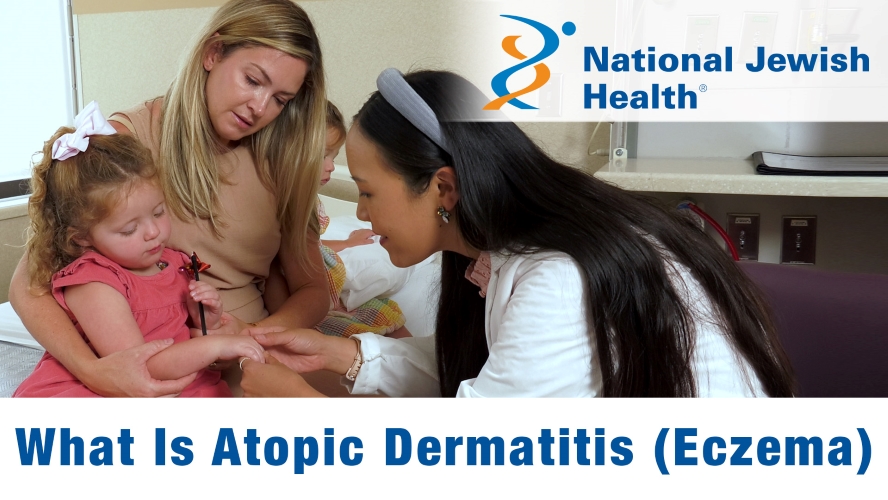 What Is Atopic Dermatitis (Eczema)