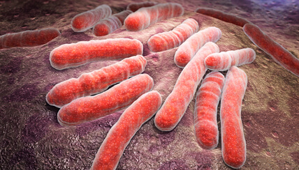 tuberculosis medical illustration